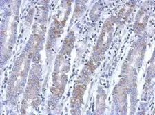 Anti-BEND2 antibody [N3C2], Internal used in IHC (Paraffin sections) (IHC-P). GTX120655