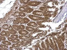 Anti-VEPH1 antibody used in IHC (Paraffin sections) (IHC-P). GTX120676
