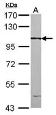 Anti-CCDC147 antibody [N1N3] used in Western Blot (WB). GTX120755