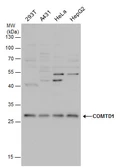 Anti-COMTD1 antibody used in Western Blot (WB). GTX120784