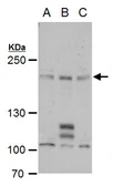 Anti-PCF11 antibody used in Western Blot (WB). GTX120962