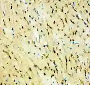 Anti-FABP5 antibody used in IHC (Paraffin sections) (IHC-P). GTX12109
