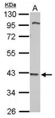 Anti-WDR69 antibody used in Western Blot (WB). GTX121145