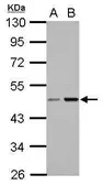 Anti-CC2D2B antibody used in Western Blot (WB). GTX121199