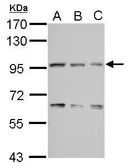 Anti-COG3 antibody [N1N2], N-term used in Western Blot (WB). GTX121212