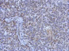 Anti-MRPL44 antibody used in IHC (Paraffin sections) (IHC-P). GTX121263