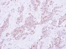 Anti-PSD4 antibody [C1C2], Internal used in IHC (Paraffin sections) (IHC-P). GTX121282