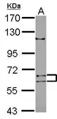 Anti-TENR antibody [N1C1] used in Western Blot (WB). GTX121377