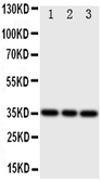 Anti-Bone Sialoprotein antibody used in Western Blot (WB). GTX12155