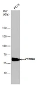 Anti-ZBTB46 antibody used in Western Blot (WB). GTX121617