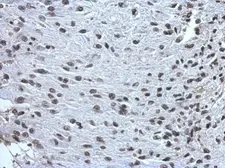 Anti-ZNF649 antibody used in IHC (Paraffin sections) (IHC-P). GTX121655