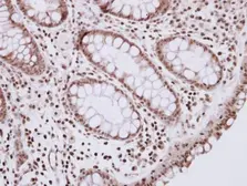 Anti-R3HDM2 antibody [N3C2], Internal used in IHC (Paraffin sections) (IHC-P). GTX122103