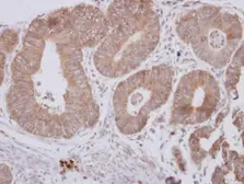 Anti-CPEB1 antibody used in IHC (Paraffin sections) (IHC-P). GTX122410