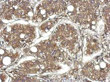 Anti-CYFIP1 antibody [N1N2], N-term used in IHC (Paraffin sections) (IHC-P). GTX122467