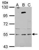 Anti-ZNF513 antibody used in Western Blot (WB). GTX122468