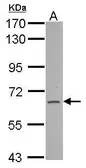 Anti-FAM73A antibody used in Western Blot (WB). GTX122522