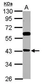 Anti-BRMS1L antibody used in Western Blot (WB). GTX122598