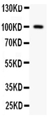 Anti-F2 antibody used in Western Blot (WB). GTX12299