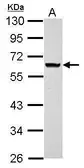 Anti-ANKRD53 antibody used in Western Blot (WB). GTX123019