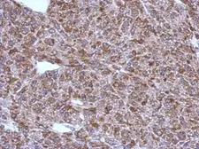 Anti-ACSM1 antibody used in IHC (Paraffin sections) (IHC-P). GTX123303