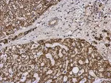 Anti-PECI antibody used in IHC (Paraffin sections) (IHC-P). GTX123947