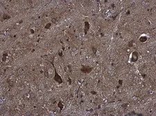 Anti-KIFC2 antibody [N3C2], Internal used in IHC (Paraffin sections) (IHC-P). GTX124082