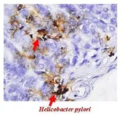Anti-Helicobacter pylori urease B antibody used in IHC (Paraffin sections) (IHC-P). GTX124109