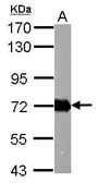 Anti-Helicobacter pylori urease B antibody used in Western Blot (WB). GTX124110