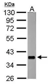 Anti-nrv2.1 antibody used in Western Blot (WB). GTX124112