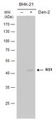 Anti-Dengue virus NS1 protein antibody (Biotin) used in Western Blot (WB). GTX124280-02