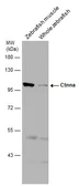 Anti-Ctnna antibody used in Western Blot (WB). GTX124378