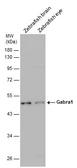 Anti-Gabra1 antibody used in Western Blot (WB). GTX125728