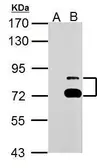 Anti-TTC39B antibody used in Western Blot (WB). GTX125938