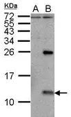 Anti-Influenza A virus NS2 / NEP antibody used in Western Blot (WB). GTX125952