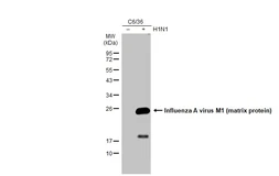 Anti-Influenza A virus M1 (matrix protein) antibody used in Western Blot (WB). GTX127356