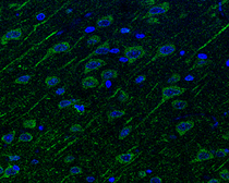 Anti-Neuropilin 1 antibody used in IHC (Paraffin sections) (IHC-P). GTX127947