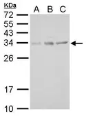 Anti-UCP4 antibody used in Western Blot (WB). GTX128022