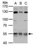 Anti-USP3 antibody used in Western Blot (WB). GTX128238