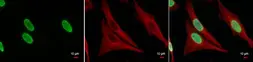 Anti-Histone H3K27ac (Acetyl Lys27) antibody used in Immunocytochemistry/ Immunofluorescence (ICC/IF). GTX128944