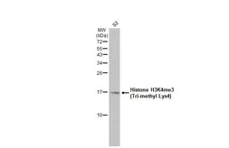 Anti-Histone H3K4me3 (Tri-methyl Lys4) antibody used in Western Blot (WB). GTX128954