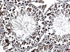 Anti-RUVBL2 antibody used in IHC (Paraffin sections) (IHC-P). GTX128970