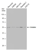 Anti-Visfatin antibody used in Western Blot (WB). GTX128980