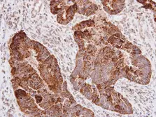 Anti-L1CAM antibody used in IHC (Paraffin sections) (IHC-P). GTX129010