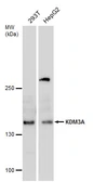 Anti-KDM3A antibody used in Western Blot (WB). GTX129046