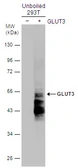 Anti-GLUT3 antibody used in Western Blot (WB). GTX129175