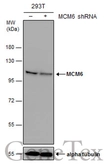 Anti-MCM6 antibody used in Western Blot (WB). GTX129216