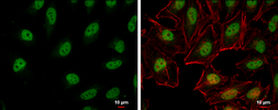 Anti-RFC1 antibody used in Immunocytochemistry/ Immunofluorescence (ICC/IF). GTX129291