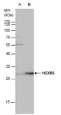 Anti-HOXB5 antibody used in Western Blot (WB). GTX129322
