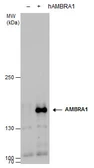 Anti-AMBRA1 antibody used in Western Blot (WB). GTX129487