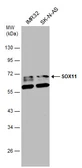 Anti-SOX11 antibody used in Western Blot (WB). GTX129501